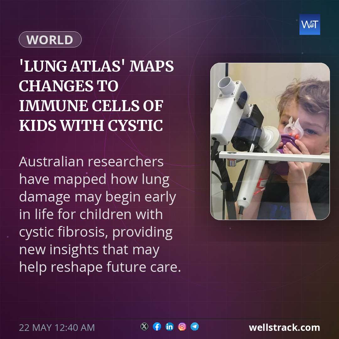 'Lung atlas' maps changes to immune cells of kids with cystic fibrosis — WellsTrack