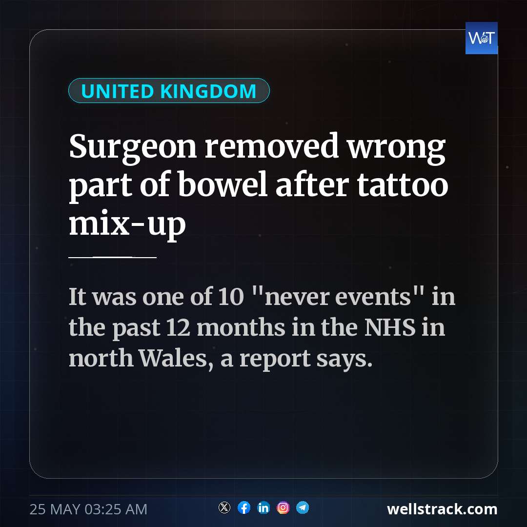 Surgeon removed wrong part of bowel after tattoo mix-up